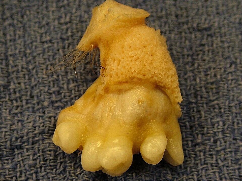 Imagem de tumor amarelo com dentes.